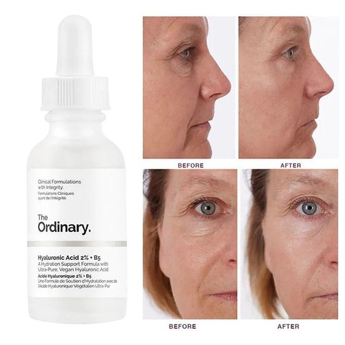 The Ordinary Hyaluronic Acid 2% + B5, 30ml